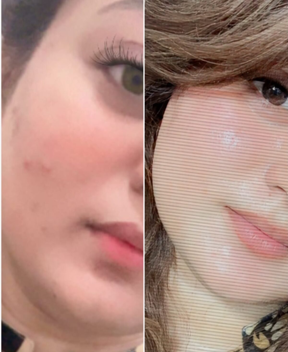 Summer whitening bundal
