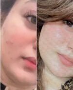 Summer whitening bundal